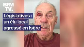 "J'ai pris un coup de poing": un élu de 77 ans agressé en Isère alors qu'il collait des affiches pour Olivier Véran